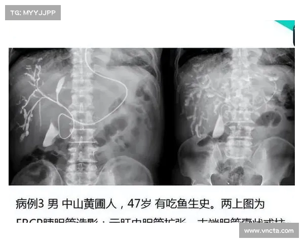 浑身都是“寄生虫”的鱼,卖鱼老板为何绝不碰?你还敢吃吗?(身上有寄生虫的鱼能吃吗) 浑身都是“寄生虫”的鱼,卖鱼老板为何绝不碰?你还敢吃吗?(身上有寄生虫的鱼能吃吗)