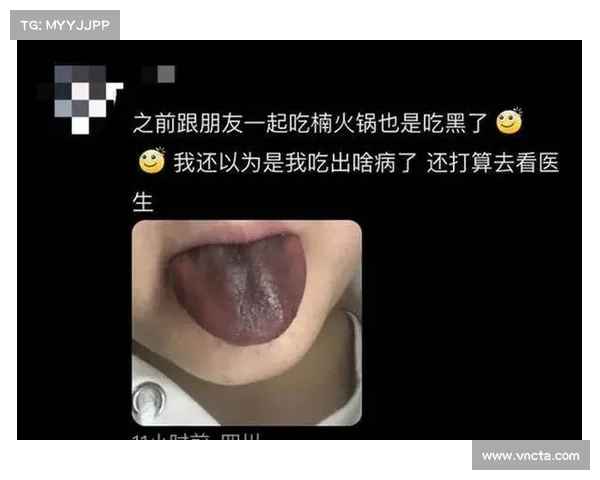 火锅舌头发黑原因揭秘:楠火锅铁锅养护失误致歉事件解析(吃火锅舌头烫了怎么办) 火锅舌头发黑原因揭秘:楠火锅铁锅养护失误致歉事件解析(吃火锅舌头烫了怎么办)